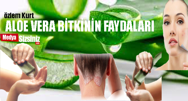 Aloe Vera Bitkinin Faydaları....!!!